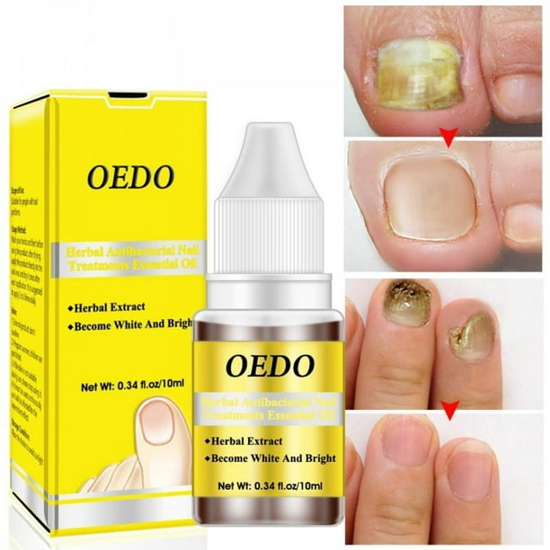 Health Skin Care Herbal Nail Repair Treatment Essential Oil Onychomycosis Remove